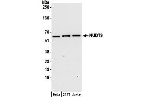 Western Blotting (WB) image for anti-Nudix (Nucleoside Diphosphate Linked Moiety X)-Type Motif 9 (NUDT9) (AA 50-100) antibody (ABIN7452621)