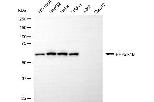 Western blotting analysis using PPP2R1B antibody (ABIN7800022). (PPP2R1B 抗体)