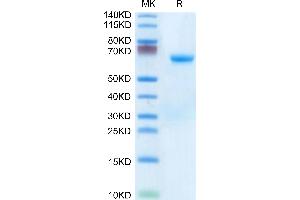 Human CHODL on Tris-Bis PAGE under reduced condition. (CHODL Protein (AA 22-216) (Fc Tag))