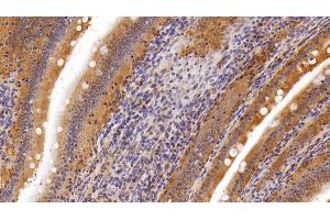 Detection of LPL in Rat Small intestine Tissue using Polyclonal Antibody to Lipoprotein lipase (LPL) (Lipoprotein Lipase 抗体  (AA 28-474))