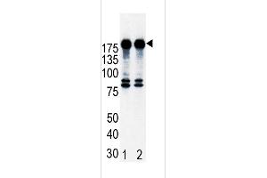 Western blot analysis of ErbB2 (arrow) in T47D cell lysates, either noninduced (Lane 1) or induced with HRG (Lane 2). (ErbB2/Her2 抗体  (N-Term))