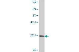 Western Blot detection against Immunogen (33. (NAGK 抗体  (AA 1-69))
