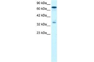 WB Suggested Anti-NFKBIB Antibody Titration:  1. (NFKBIB 抗体  (N-Term))