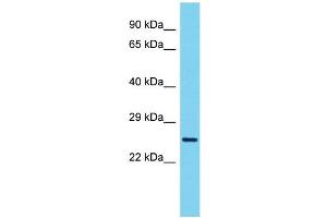 Host: Rabbit Target Name: VCX3A Sample Type: ACHN Whole Cell lysates Antibody Dilution: 1. (VCX3A 抗体  (N-Term))