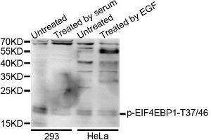 Western blot analysis of extracts of various cells, using Phospho-EIF4EBP1-T37/46 antibody (ABIN5995638). (eIF4EBP1 抗体  (pThr36))