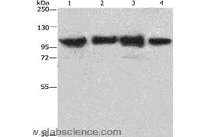 Western blot analysis of Lovo cell and mouse kidney tissue, 231 and hepG2 cell, using ACTN4 Polyclonal Antibody at dilution of 1:485