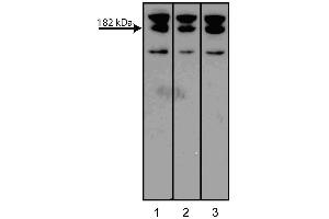 Western blot analysis of AF6 on a PC-12 cell lysate (Rat neuroblastoma, ATCC CRL-1721). (Afadin 抗体  (AA 1091-1233))