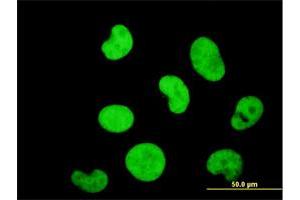 Immunofluorescence of monoclonal antibody to ZNF207 on HeLa cell. (ZNF207 抗体  (AA 1-110))