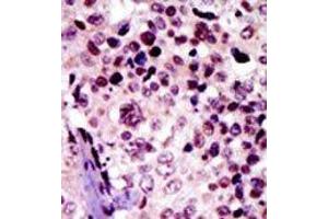 Image no. 2 for anti-Protein Kinase, CAMP-Dependent, Regulatory, Type I, beta (PRKAR1B) (N-Term) antibody (ABIN359120)