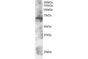 ABIN184723 staining (2µg/ml) of Daudi lysate (RIPA buffer, 30µg total protein per lane). (SWAP70 抗体  (C-Term))