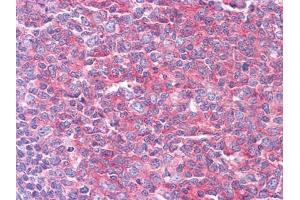 Immunohistochemical analysis of paraffin-embedded human Tonsil tissues using KARS mouse mAb (KARS 抗体  (AA 90-174))