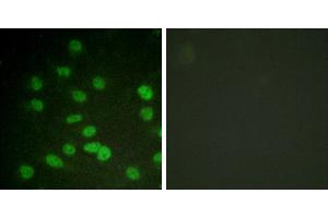 serum + -Immunohistochemistry analysis of paraffin-embedded human brain tissue using DDX3/DEAD-box Protein 3 (Phospho-Thr322) antibody. (DDX3 抗体  (pThr322))
