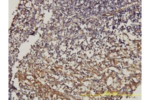 Immunoperoxidase of monoclonal antibody to CD58 on formalin-fixed paraffin-embedded human tonsil. (CD58 抗体  (AA 1-240))