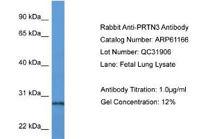 Western Blotting (WB) image for anti-Proteinase 3 (PRTN3) (N-Term) antibody (ABIN2788703) (PRTN3 抗体  (N-Term))