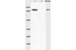 Lane 1: mouse liver lysates Lane 2: mouse lung lysates probed with Anti Phospho-TrkA (Tyr490) /TrkB (Tyr516) Polyclonal Antibody, Unconjugated (ABIN746603) at 1:200 in 4 °C. (TRKA 抗体  (pTyr496))