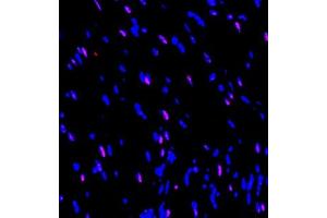 Immunofluorescence of paraffin embedded rat heart using SOCS7 (ABIN7075765) at dilution of 1:650 (300x lens) (SOCS7 抗体)
