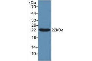 Detection of Recombinant Bcl2L2, Human using Polyclonal Antibody to B-Cell CLL/Lymphoma 2 Like Protein 2 (Bcl2L2) (BCL2L2 抗体  (AA 2-193))