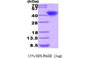 SDS-PAGE (SDS) image for Aflatoxin Beta1 Aldehyde Reductase (AKR7A2) (AA 1-359) protein (His tag) (ABIN667763) (AKR7A2 Protein (AA 1-359) (His tag))