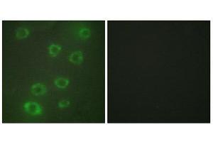 Immunofluorescence (IF) image for anti-Pentraxin 3 (PTX3) (N-Term) antibody (ABIN1849270) (PTX3 抗体  (N-Term))