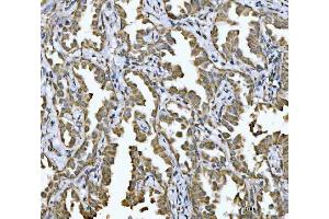 IHC analysis of NDUFV2 using anti-NDUFV2 antibody (ABIN7599154). (NDUFV2 抗体  (AA 1-249))