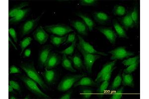 Immunofluorescence of monoclonal antibody to RBBP9 on HeLa cell. (RBBP9 抗体  (AA 87-185))