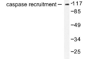 Image no. 1 for anti-Caspase Recruitment Domain Family, Member 6 (CARD6) antibody (ABIN265333) (CARD6 抗体)