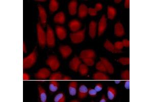 Immunofluorescence analysis of U2OS cells using TAP2 Polyclonal Antibody (TAP2 抗体)
