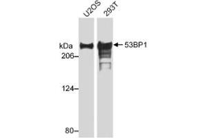 Western blot analysis of TP53BP1 by TP53BP1 polyclonal antibody .