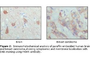 Immunohistochemical analysis of paraffin-embedded human brain (left) and breast carcinoma (right), showing cytoplasmic and membrane localization using PAR4 mouse mAb with DAB staining.