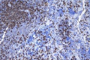 IHC analysis of CD5 using anti-CD5 antibody (ABIN7600839). (CD5 抗体  (AA 24-494))