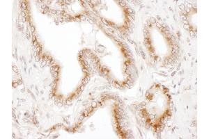 anti-Trans-Golgi Network Protein 2 (TGOLN2) (AA 175-225) antibody