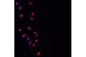 ABIN6276842 staining HepG2? (PLGF 抗体  (Internal Region))