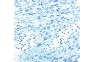 Immunohistochemical staining for human papilloma virus (HPV) type 16, L1 protein. (L1 Protein 抗体)