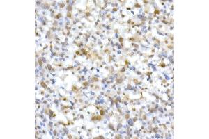 Immunohistochemistry (IHC) image for anti-SWI/SNF Related, Matrix Associated, Actin Dependent Regulator of Chromatin, Subfamily B, Member 1 (SMARCB1) (AA 77-376) antibody (ABIN6148107)