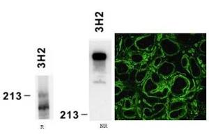 Reactivity of laminin alpha4 chain specific monoclonal antibody 3H2 on human platelet lysate by Western blotting (reducing, R and nonreducing, NR conditions) and on human embryonic kidney preparation (LAMa4 抗体)