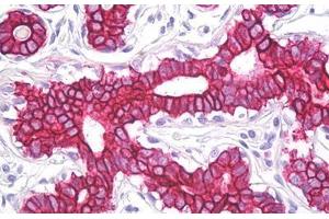 Anti-Cytokeratin 8 / Keratin 8 antibody IHC staining of human breast. (KRT8 抗体  (AA 434-483))