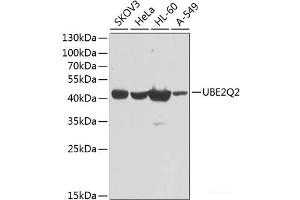 Western blot analysis of extracts of various cell lines using UBE2Q2 Polyclonal Antibody at dilution of 1:1000.