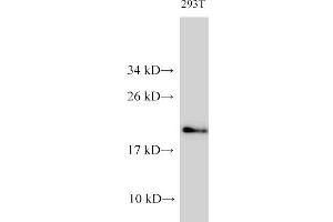 Western Blot analysis of 293T cells using CDK4 Polyclonal Antibody at dilution of 1:1000 (CDK4 抗体)