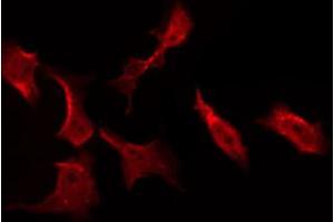 Immunofluorescence (fixed cells) (IF/ICC) image for anti-V-Akt Murine Thymoma Viral Oncogene Homolog 1 (AKT1) (pSer124) antibody (ABIN6256119)