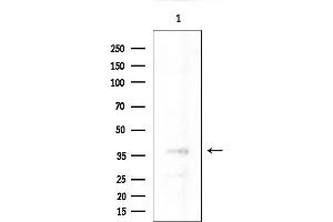 anti-Nanog Homeobox Pseudogene 8 (NANOGP8) (Internal Region) antibody