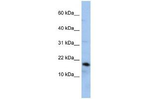 Lipocalin 1 antibody used at 1 ug/ml to detect target protein. (Lipocalin 1 抗体)