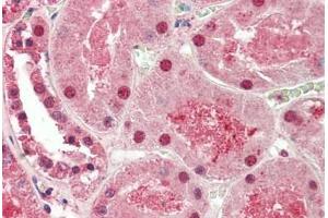 Human Kidney: Formalin-Fixed, Paraffin-Embedded (FFPE) (ST8SIA2 抗体  (AA 295-344))