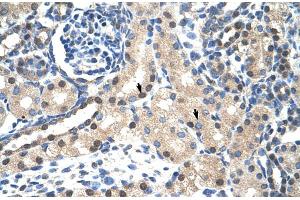 Immunohistochemistry (IHC) image for anti-Signal Transducer and Activator of Transcription 1, 91kDa (STAT1) (N-Term) antibody (ABIN2780843)
