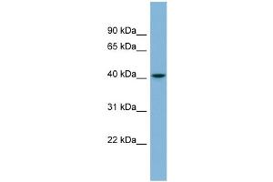 WB Suggested Anti-SERPINI1 Antibody Titration: 0. (Neuroserpin 抗体  (Middle Region))