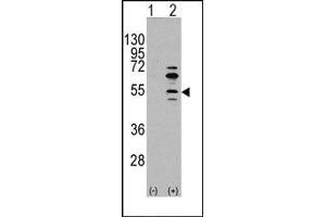Image no. 1 for anti-Myocyte Enhancer Factor 2C (MEF2C) (Ser59) antibody (ABIN358803) (MEF2C 抗体  (Ser59))