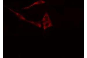 ABIN6278575 staining NIH-3T3 cells by IF/ICC. (GLYCTK 抗体  (Internal Region))