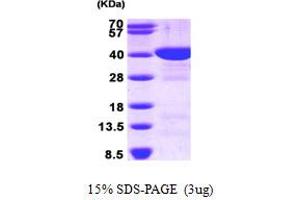Fructose-1,6-Bisphosphatase 1 (FBP1) (AA 1-338) protein (His tag)