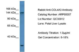 Western Blotting (WB) image for anti-Collagen, Type IV, alpha 3 (COL4A3) (N-Term) antibody (ABIN2788302)