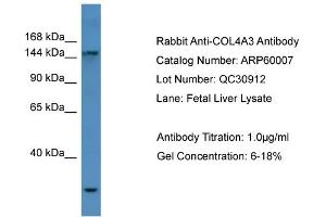 WB Suggested Anti-COL4A3  Antibody Titration: 0. (COL4a3 抗体  (N-Term))