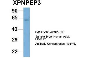 Host: Rabbit  Target Name: XPNPEP3  Sample Tissue: Human Adult Placenta  Antibody Dilution: 1.
